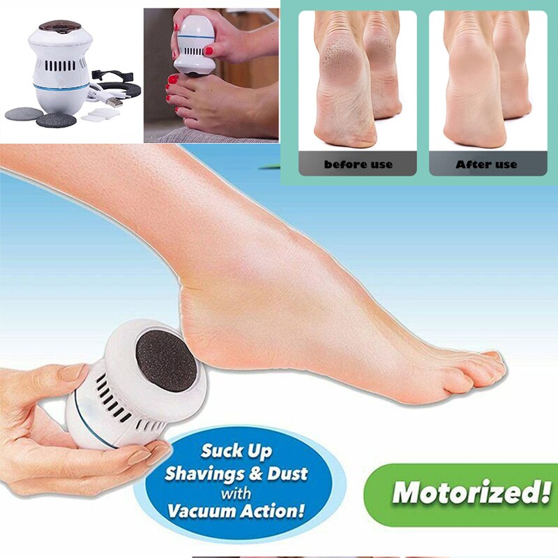 Foot Exfoliate Dead Skin Callus Remover Heel Removal Scraper